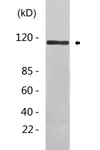 Androgen Receptor Antibody