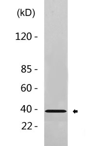 HDAC11 Antibody