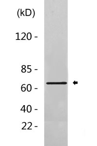 NF-κB p65 Antibody