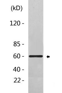 ER alpha Antibody