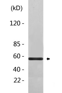 Phospho-c-Myc (T58 + S62) Antibody