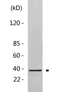 Phospho-LAT (Y191) Antibody