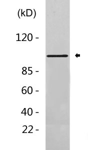 Aconitase 1 Antibody