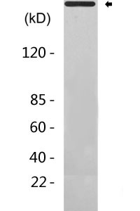 Phospho-ATM (S1981) Antibody