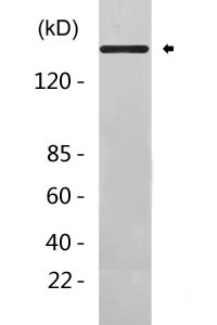 EGFR (ErbB 1) Antibody