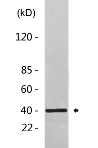 CDX2 Antibody