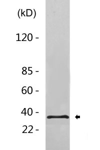 PPP1CA+PPP1CB Antibody