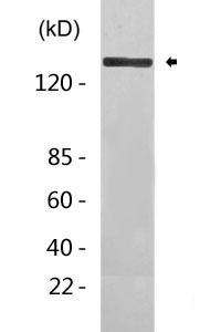 Collagen I Antibody