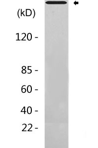 Plectin Antibody