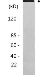 LRRK2  Antibody