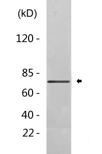 GRP78 BiP Antibody