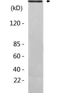 LRRK2 Antibody