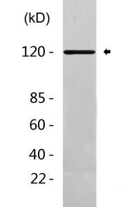 HIF-1 alpha Antibody