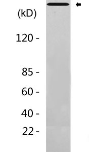 ATM Antibody