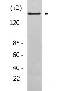 ErbB2 (HER2) Antibody