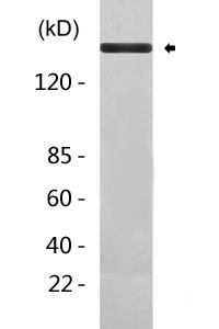 Phospho-EGFR (Y1068) Antibody  