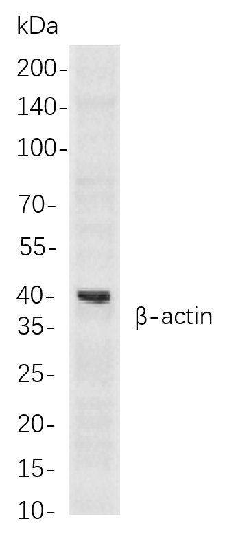 β-actin Rabbit mab