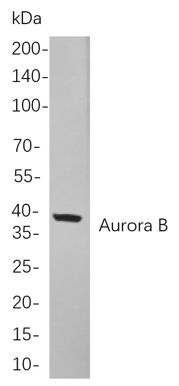 Aurora B Rabbit mab