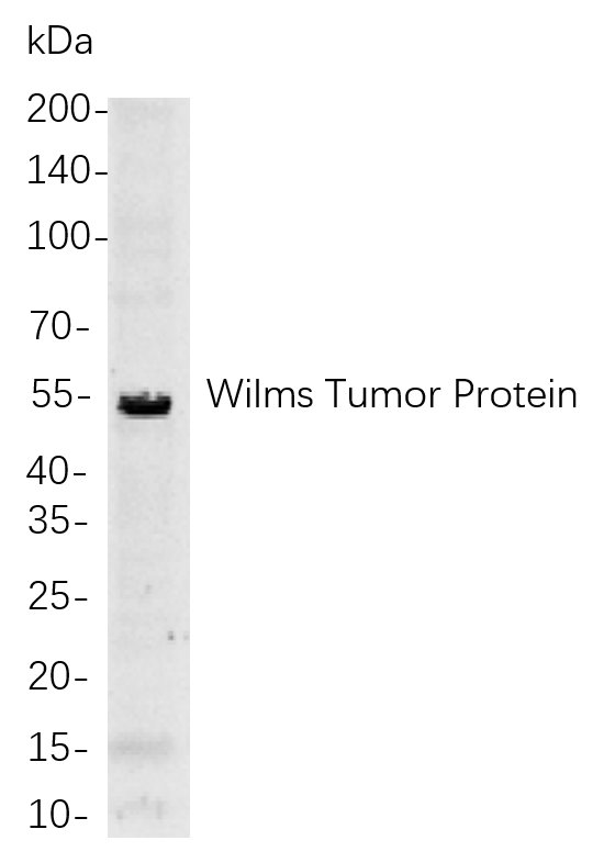 Wilms Tumor Protein Rabbit mab