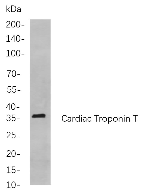 Cardiac Troponin T Rabbit mab