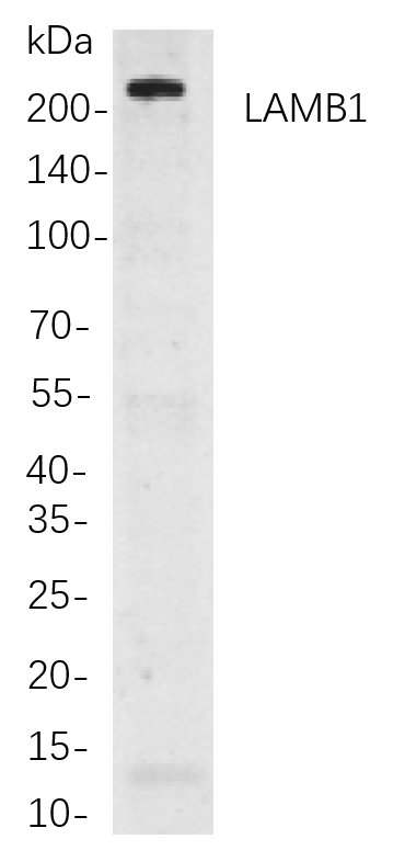 LAMB1 Rabbit mab